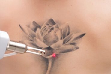 Aromaterapia